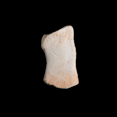 Nasal_view