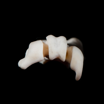 Basal_view