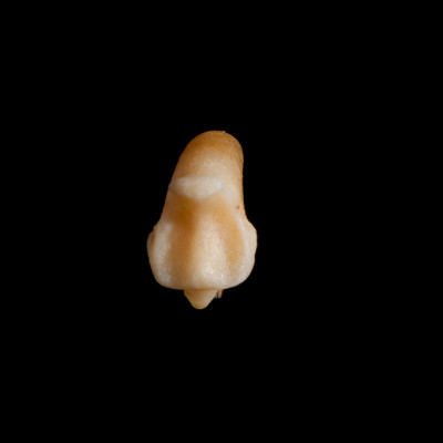 Nuchal_view