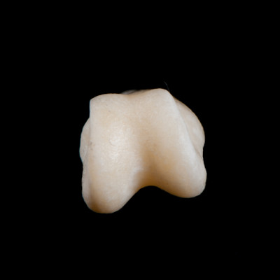 Basal_view