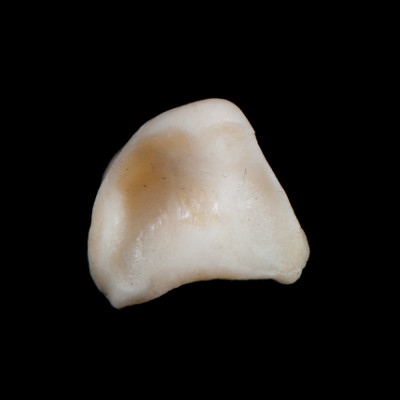 dorsal_view