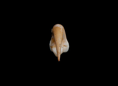 Nasal_view