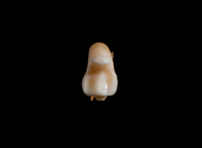 Nuchal_view