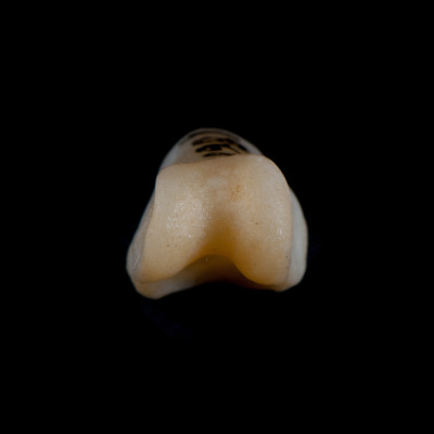 Basal_view