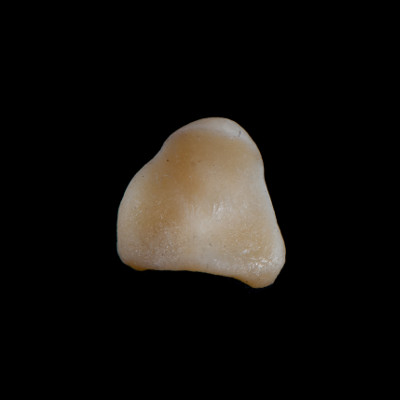 dorsal_view