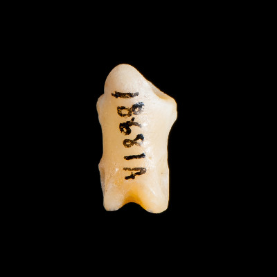 Nasal_view