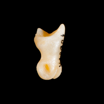 Right_side_view
