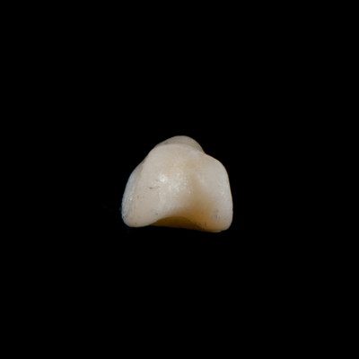 Basal_view