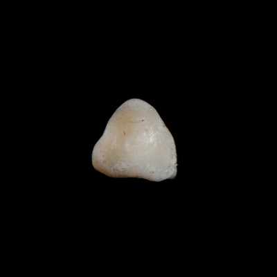 dorsal_view