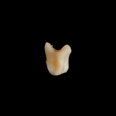 Left_side_view