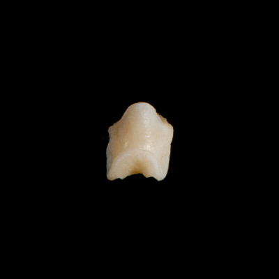 Nasal_view