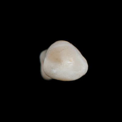 dorsal_view
