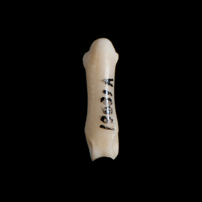 Nasal_view