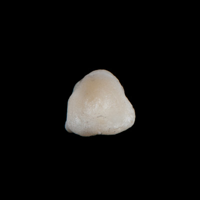 dorsal_view