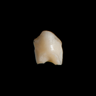 Nasal_view