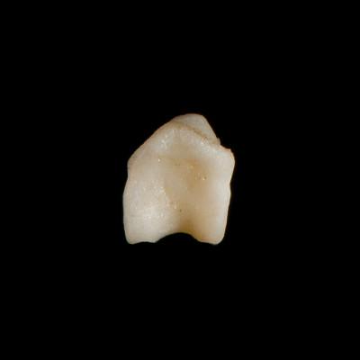 Nuchal_view