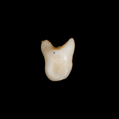 Right_side_view