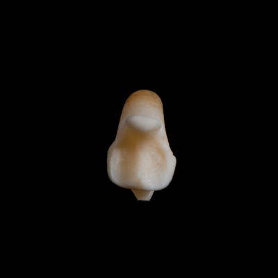 Nuchal_view
