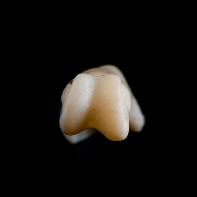 Basal_view