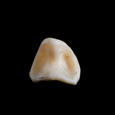 dorsal_view
