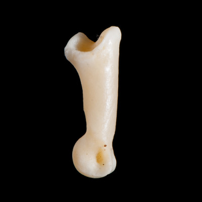 Right_side_view