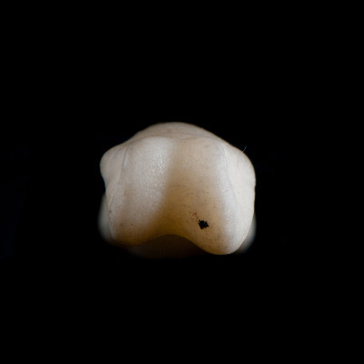 Basal_view