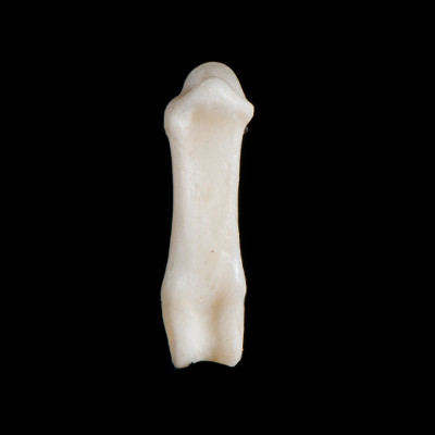Nuchal_view
