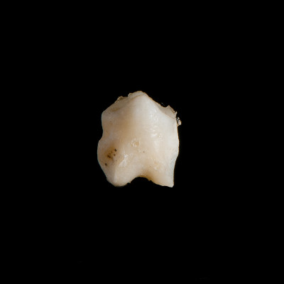 Nasal_view