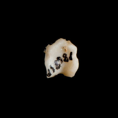 Nuchal_view