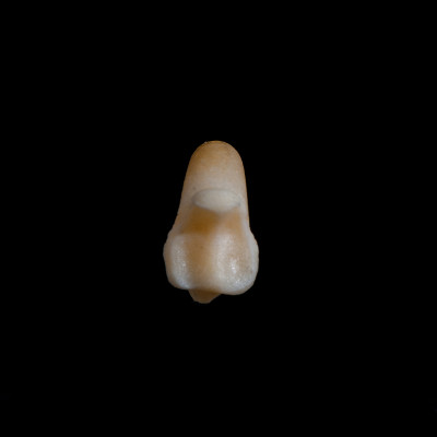Nuchal_view