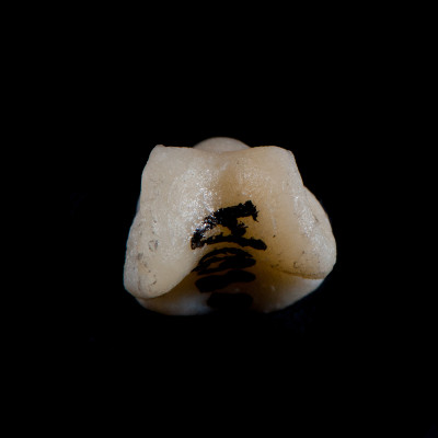 Basal_view