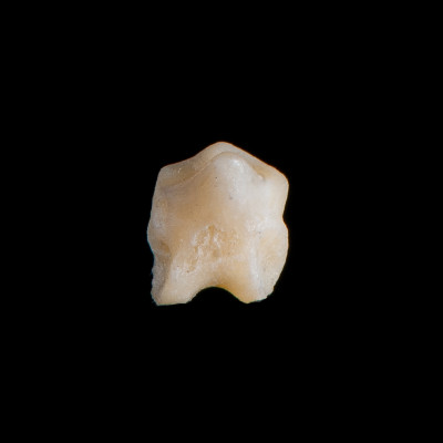 Nasal_view