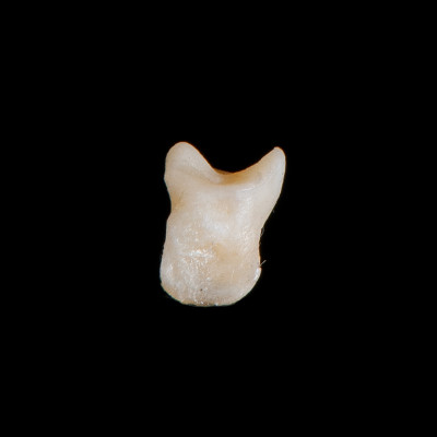 Right_side_view