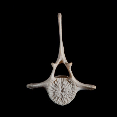 Nasal_view